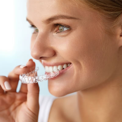 invisalign info